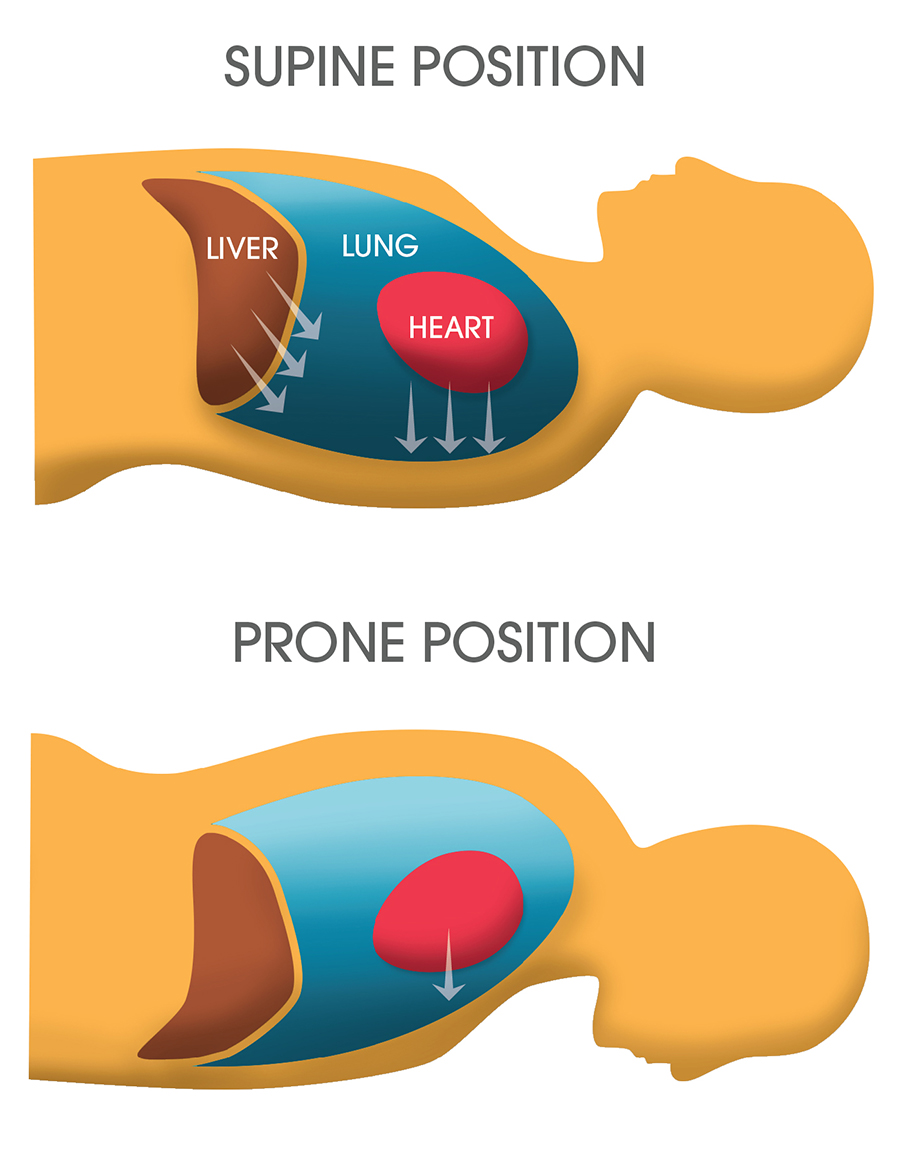 Supine position