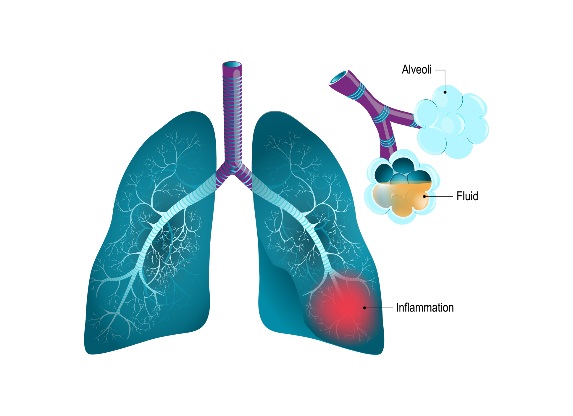 lungs and alveoli feature image