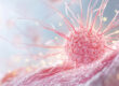 early-stage breast cancer cells
